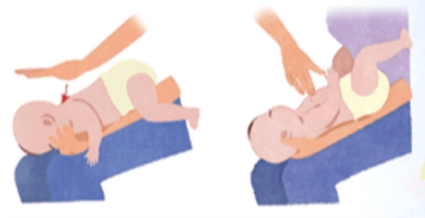 「一歲以下嬰兒」哈姆立克法