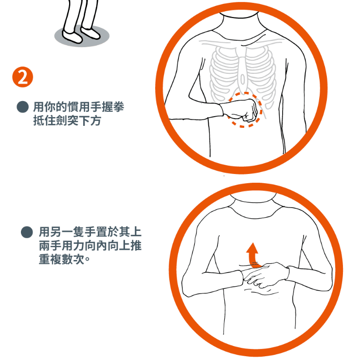 對自己施作哈姆立克法